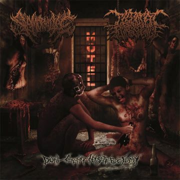Cover art for Dual Gimp Hysterectomy