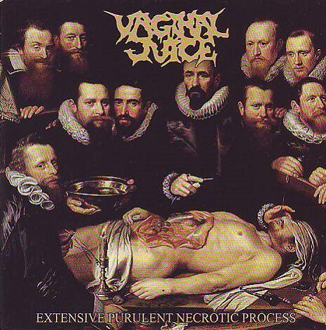 Vaginal Juice - Extensive Purulent Necrotic Process Vaginal Juice - Extensive Purulent Necrotic Process
