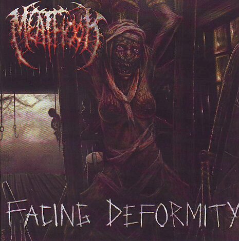 Meathook - Facing Deformity Meathook - Facing Deformity