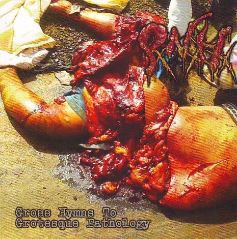 Pancreatite Necro Hemorragica - Gross Hymns To Grotesque Pathology Pancreatite Necro Hemorragica - Gross Hymns To Grotesque Pathology