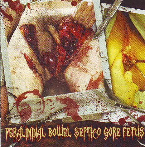5 Way Split CD - Goregrind 5 Way Split CD - Goregrind