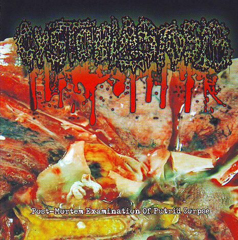 Cystoblastosis - Post-Mortem Examination Of Putrid Corpse Cystoblastosis - Post-Mortem Examination Of Putrid Corpse