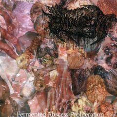 Globularcyst – Fermented Abscess Proliferation
