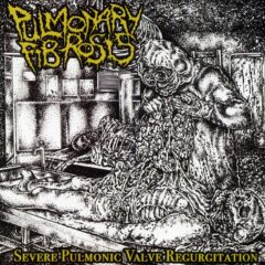 Pulmonary Fibrosis – Severe Pulmonic Valve Regurgitation