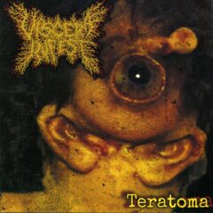 Viscera Infest - Teratoma Viscera Infest - Teratoma