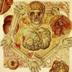 G​.​I​.​S​.​T. (Gastrointestinal Stromal Tumor​)​ - A Postmortem Diagnosis Of Malignant Submucosal Tumors