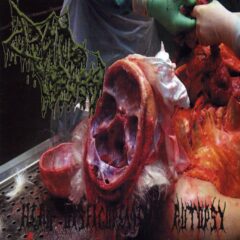Drain of Impurity - Head Disfigurement Autopsy Drain of Impurity - Head Disfigurement Autopsy