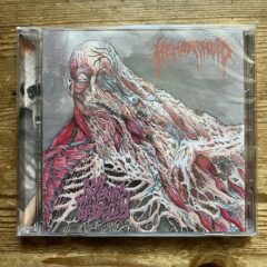 Hemorrhoid – Raw Materials of Decay