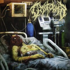 Chordoma - Chordoma