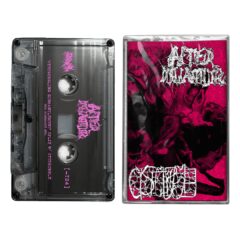 AfterDismantling / Cystgurgle - Cystgurgling Dismantlement (Split Cassette)